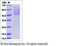 Sino Biological Human PARM1 / PARM-1 Protein (His Tag) 100ug, Quantity: