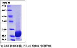 Sino Biological Recombinant Human GMFG Protein (His Tag), Quantity: Each
