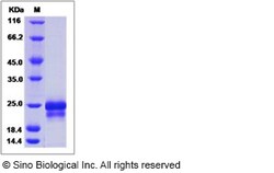 Sino Biological Recombinant Human PFDN5 Protein (His Tag), Quantity: Each