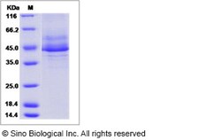 Sino Biological Recombinant Human MRAP Protein (hFc Tag), Quantity: Each