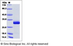 Sino Biological Recombinant Human GSTM5 Protein (His Tag), Quantity: Each