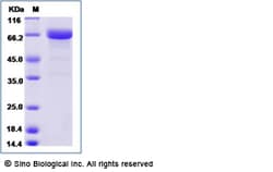 Sino Biological Human LRRC32 Protein (His Tag) 50ug, Quantity: Each of