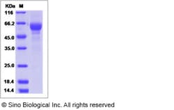Sino Biological Recombinant Human Somatostatin Receptor 1/SSR1 Protein