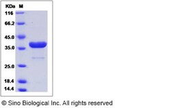 Sino Biological Recombinant Human PIG3 Protein (His Tag), Quantity: Each