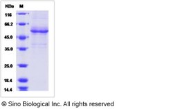 Sino Biological Recombinant Human Amelotin Protein (mFc Tag), Quantity:
