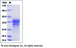 Sino Biological Human INSL6 / RIF1 Protein (His Tag) 100ug, Quantity: Each