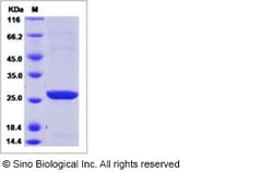 Sino Biological Recombinant Human GSTT2B Protein (His Tag), Quantity: Each
