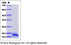 Sino Biological Recombinant Human MUSTN1 Protein (His Tag), Quantity: Each