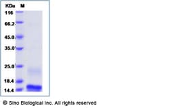 Sino Biological Recombinant Human alpha Lactalbumin/LALBA Protein (His