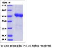 Sino Biological Human ST8SIA1 / GD3S Protein (His Tag) 100ug, Quantity: