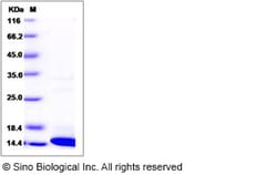 Sino Biological Recombinant Human COX5B Protein (His Tag), Quantity: Each