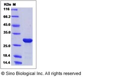 Sino Biological Recombinant Human RGS1 Protein (His Tag), Quantity: Each