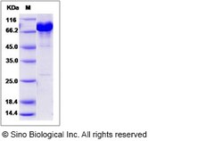 Sino Biological Human NCF-2 / NCF2 / P67phox Protein (His & GST Tag) 50ug,