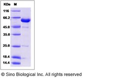 Sino Biological Human NCF2 / NCF-2 / P67phox Protein 100ug, Quantity: Each