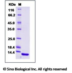 Sino Biological Human IL5 / Interleukin 5 Protein 100ug, Quantity: Each