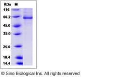 Sino Biological Recombinant Human BBOX1 Protein (His & GST Tag), Quantity: