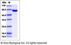 Sino Biological Recombinant Human Sphingosine Kinase 1 Protein (His & GST