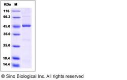 Sino Biological Human SPHK1 / Sphingosine Kinase 1 Protein 50ug, Quantity: