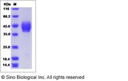 Sino Biological Recombinant Human CADM2 Protein (ECD, His Tag), Quantity: