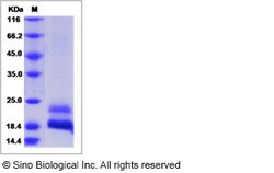 Sino Biological Recombinant Human CDNF Protein (His Tag), Quantity: Each
