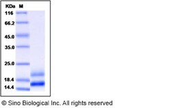 Sino Biological VEGF121b Protein, Human, Recombinant, Quantity: Each of