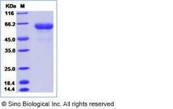 Sino Biological Recombinant Human LRRTM2 Protein (hFc Tag), HPLC-verified,