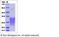 Sino Biological Recombinant Human MUCL1 Protein (His Tag), Quantity: Each