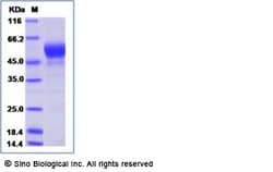Sino Biological Recombinant Human PGLYRP4 Protein (His Tag), Quantity: