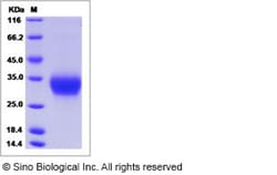 Sino Biological Recombinant Human ULBP6/RAET1L Protein (His Tag), Quantity: