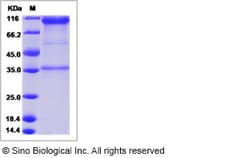 Sino Biological Recombinant Human EphA1 Protein (hFc Tag), HPLC-verified,