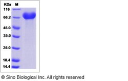 Sino Biological Recombinant Human EphA1 Protein (ECD, His Tag), Quantity: