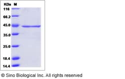 Sino Biological Human NEU2 / Sialidase-2 Protein (His Tag) 100ug, Quantity: