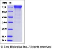 Sino Biological Recombinant Human IL-31RA Protein (ECD, hFc Tag), HPLC-verified,
