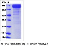 Sino Biological Recombinant Human IL-31RA Protein (His Tag), HPLC-verified,