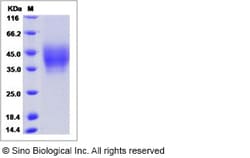 Sino Biological Human NPTN / SDFR1 Protein (His Tag, ECD) 100ug, Quantity: