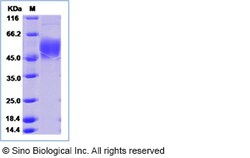 Sino Biological Recombinant Human ATP1B2 Protein (His Tag), Quantity: Each