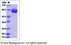Sino Biological Human TMPRSS11B Protein (His Tag) 100ug, Quantity: Each
