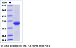 Sino Biological Human BTN3A1 / CD277 Protein (His Tag) 100ug, Quantity: