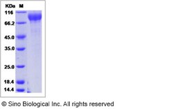 Sino Biological Human GPR133 / PGR25 Protein (ECD, His Tag) 100ug, Quantity: