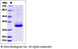 Sino Biological Human RAB27B Protein (His Tag) 100ug, Quantity: Each of