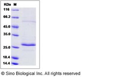 Sino Biological Recombinant Human RAB27B Protein, Quantity: Each of 1