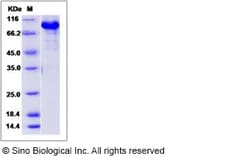Sino Biological Recombinant Human KIAA1279 Protein (His & GST Tag), Quantity: