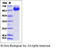 Sino Biological Recombinant Human KIAA1279 Protein, Quantity: Each of 1
