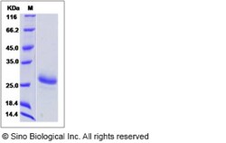 Sino Biological Human Cardiotrophin-1 / CTF1 Protein 100ug, Quantity: Each