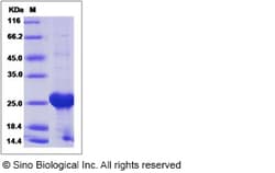 Sino Biological Human Rab6 / Rab GTPases / RAB6A Protein (His Tag) 50ug,