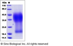 Sino Biological Recombinant Human Glycophorin A Protein (His Tag), HPLC-verified,