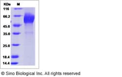 Sino Biological Human CALCR / Calcitonin receptor Protein (Fc Tag) 100ug,