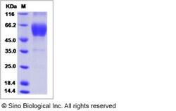 Sino Biological Human CALCR / Calcitonin receptor Protein (Fc Tag, ECD)