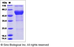 Sino Biological Recombinant Human CD300f/LMIR3 Protein (hFc Tag), Quantity: