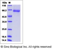 Sino Biological Human FCRL2 / FCRH2 Protein (His Tag) 200ug, Quantity: